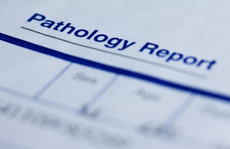 Routine and Complex Reporting